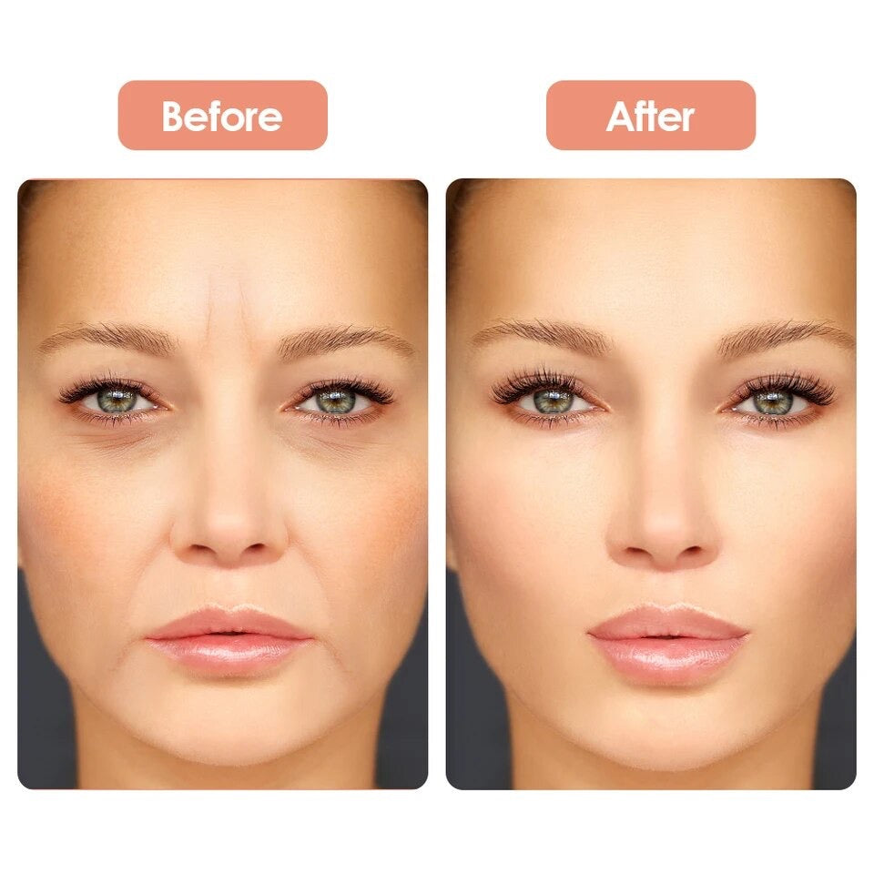 Anti Falten Silikon Pads